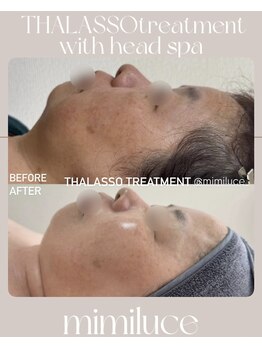 ミミルーチェ(mimiluce)/タラソハーブピーリング