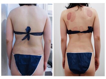 アイディエム 新宿店(IDM)/【モニター】163ｃｍ・20代