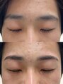 ホワイトアイ 立川(WHITE EYE)&nbsp;ストレートアーチの形でやわらかな印象