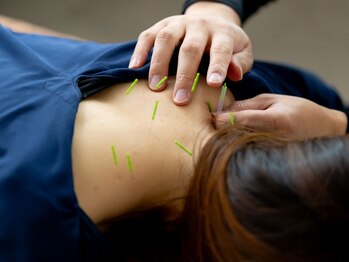 えもと鍼灸整体院の写真/【40代以上の妊娠実績多数】授かるための身体を土台から整える。独自の総合ケアで理想の身体環境作りを◎