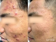 アスポーテ(ASBEAUTE)の雰囲気(メンズフェイシャルやってます!男性のお客様急増化中です!!)