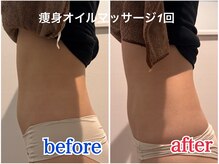 シイ(She)/痩身オイルマッサージ