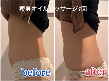 シイ(She)/痩身オイルマッサージ