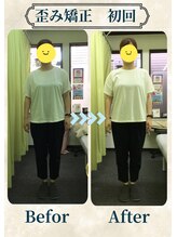 アミーゴ整体院/ビフォーアフター