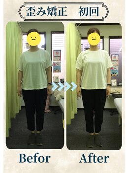 アミーゴ整体院/ビフォーアフター