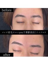 ユー 千葉駅前店(you)/ビフォ－アフター写真