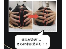 寿 上野院(KOTOBUKI)の雰囲気（初回でも変化が感じられる技術力！肩こり/上野/姿勢改善）