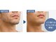 ネオビューティーラボ(NEO beauty labo)の写真/【メンズの剛毛・ヒゲ・VIO悩みに】
清潔感のあるツルスベ肌へ