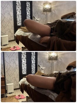 ソレイユ/股関節周りの可動域アップ