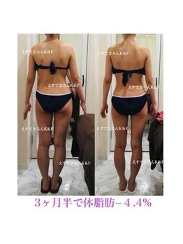 えすてさろん ケイアンドエフ(k&f)/施術結果3ヶ月半