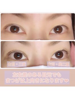 マホロ(mahoro)/左右差ある目元も