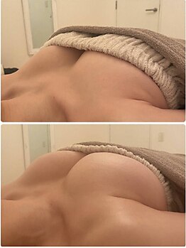 美人バスト 千葉店/バストアップ