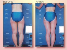 ジュリア オージェ 天王寺店/ ビフォーアフター（エンダ)