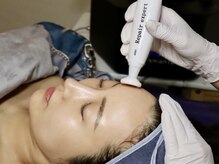 バイ リス(by LYS.)/【プラズマニア】施術工程