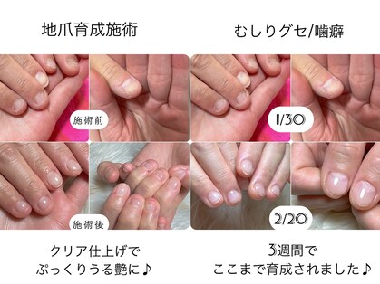 スマイル ネイル ラボラトリー(Smile nail laboratory)の写真