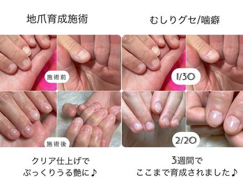 スマイル ネイル ラボラトリー(Smile nail laboratory)