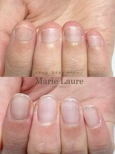 マリーロール 梅田店(Marie Laure)/深爪改善/自爪育成/ネイルケア