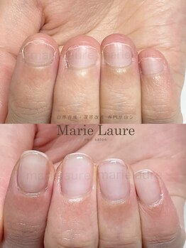 マリーロール 梅田店(Marie Laure)/深爪改善/自爪育成/ネイルケア