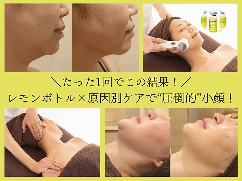 肌質改善エステサロン♡ 公式】肌質改善専門サロン THE SALON/SUHADA SALON | 【東京都 麻布十