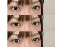 シアミス(SIAMIHS)/トリートメント