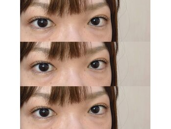 シアミス(SIAMIHS)/トリートメント