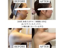 ヨサパーク フェリシア 西荻窪(YOSA PARK Felicia)の雰囲気（こんなに痩せるなんて！！と喜びの声♪）