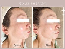 シロカネ 光の森店(SHIROKANE)/韓国式小顔コルギ☆