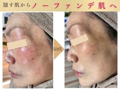 エソア(esoa)の写真