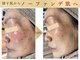 エソア(esoa)の写真