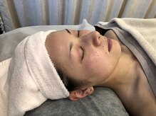 フローレス 仙台(FLAWLESS)/お顔脱毛・施術風景1♪つど払い