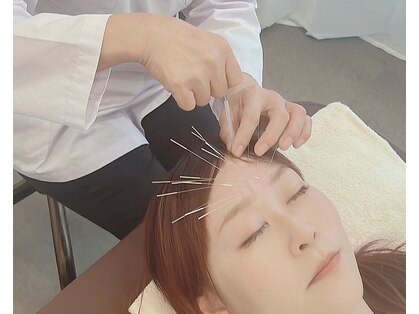 鍼さつきの写真