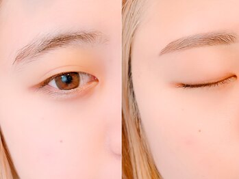 リトラリス(Littoralis)/