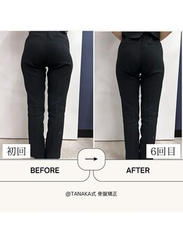 田中整骨鍼灸院 福岡白金院/骨盤矯正