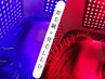 【30代～の毛髪トラブルに☆】育(発)毛LED× あたま美容鍼 50分/12000→7500