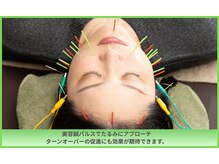 晴々の雰囲気（お身体、お悩みに合わせた鍼を行います！）