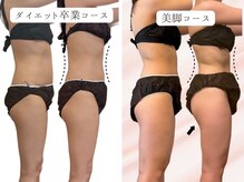 ヨサパーク リバティ 池袋東口店(YOSA PARK Liberty)/Before＆After