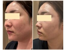 ビューティーサロンリノ 三宮店(Lino)/