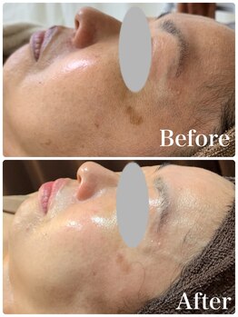 ルタンリッシュ ハナレ(Lutan Riche 花麗)/