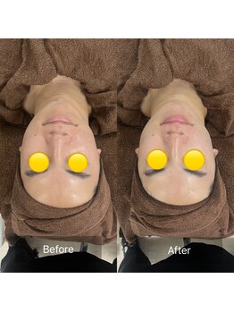 トニック バイ まつもと整骨院鍼灸院(Tonic)/★Before After★豊中/コルギ