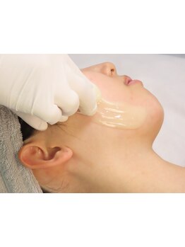 顔脱毛がしたい