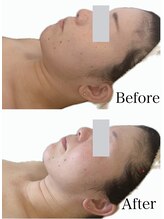 リブ 三軒茶屋(LiB)/小顔、むくみ、歪みケア