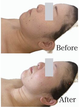 リブ 三軒茶屋(LiB)/小顔、むくみ、歪みケア