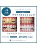 【白さ徹底】プラチナムセルフホワイトニング3回来店(10分照射×3回/来店)
