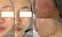 マール(MARL.)