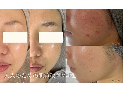 マール(MARL.)の写真