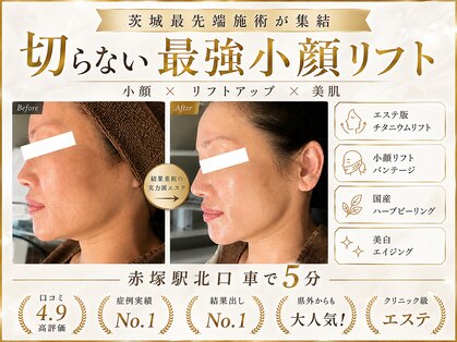 プラウディア(PROUDIA)の写真