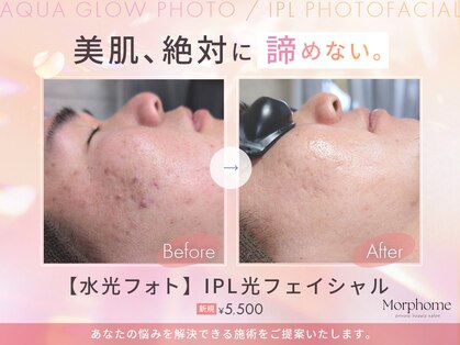 モルフォム(Morphome)の写真