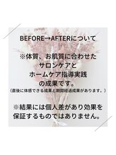 ジュネラ ボーテ(Jenela beaute)/掲載BEFORE→AFTERについて