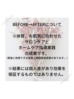 ジュネラ ボーテ(Jenela beaute)/掲載BEFORE→AFTERについて