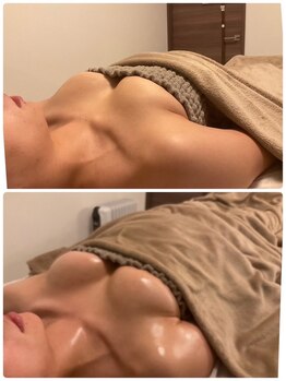 美人バスト 札幌店/バストアップ×育乳 ◇症例◇